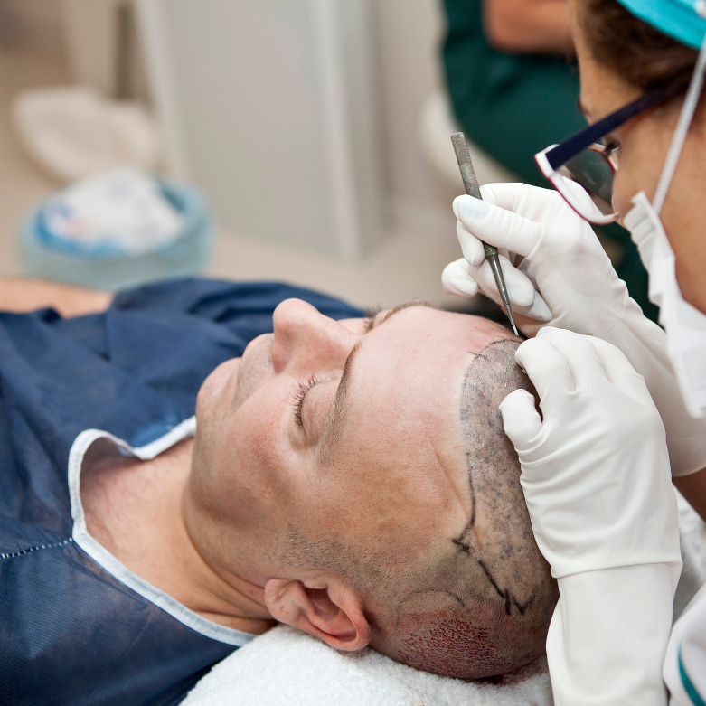 Hair Transplant- Hair Care
