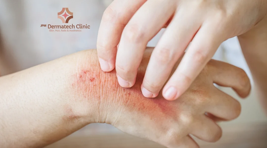 Itchy Skin or Rashes? Here’s When to See a Dermatologist