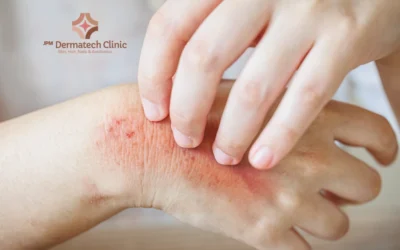 Itchy Skin or Rashes? Here’s When to See a Dermatologist