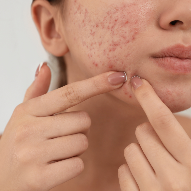 Medical Dermatology