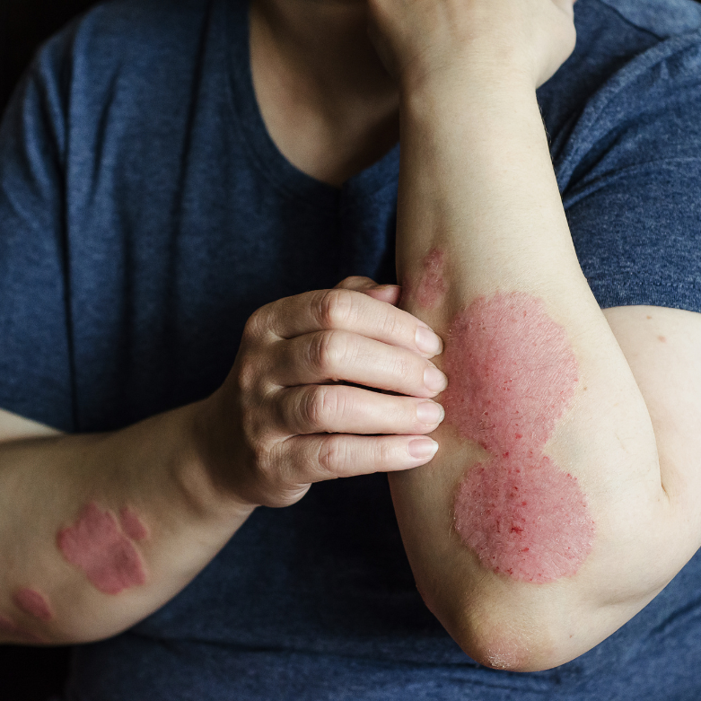 Medical Dermatology