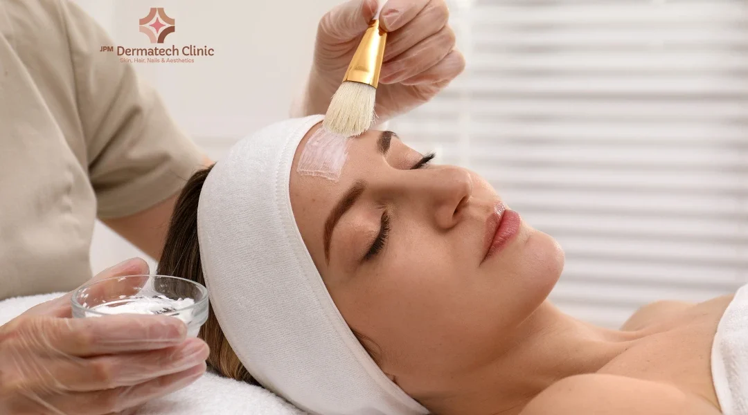 Chemical Peels & Skin Rejuvenation: Reveal Healthier Skin