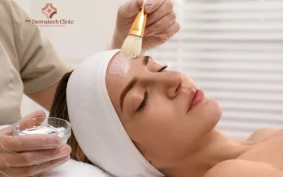 Chemical Peels & Skin Rejuvenation: Reveal Healthier Skin